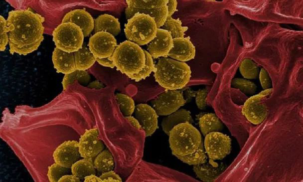 ѩ��������ù����ʲô����ʲôҪʹ�ÿ�����ù����